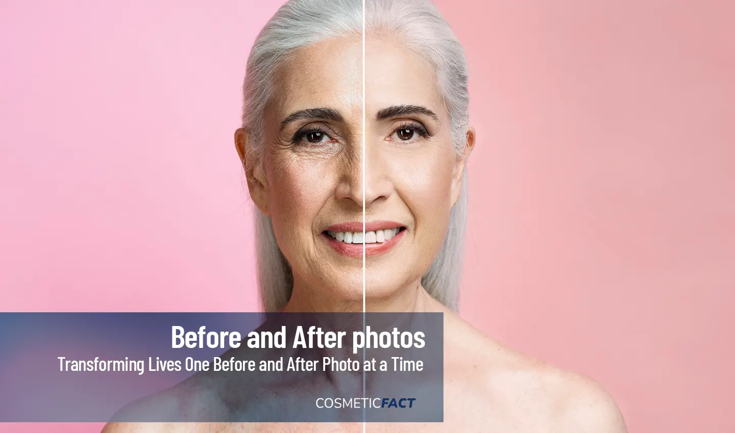 Displaying transformation through power of facelift photos