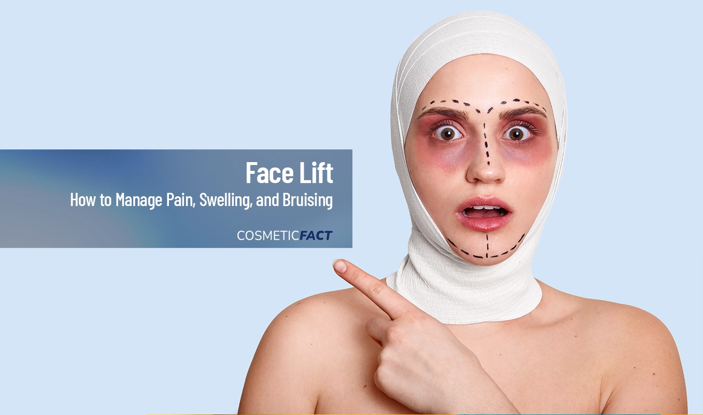 A person's face with bruises and swelling after facelift surgery alongside text reading Facelift Surgery Recovery Tips: Managing Pain, Swelling, and Bruising.