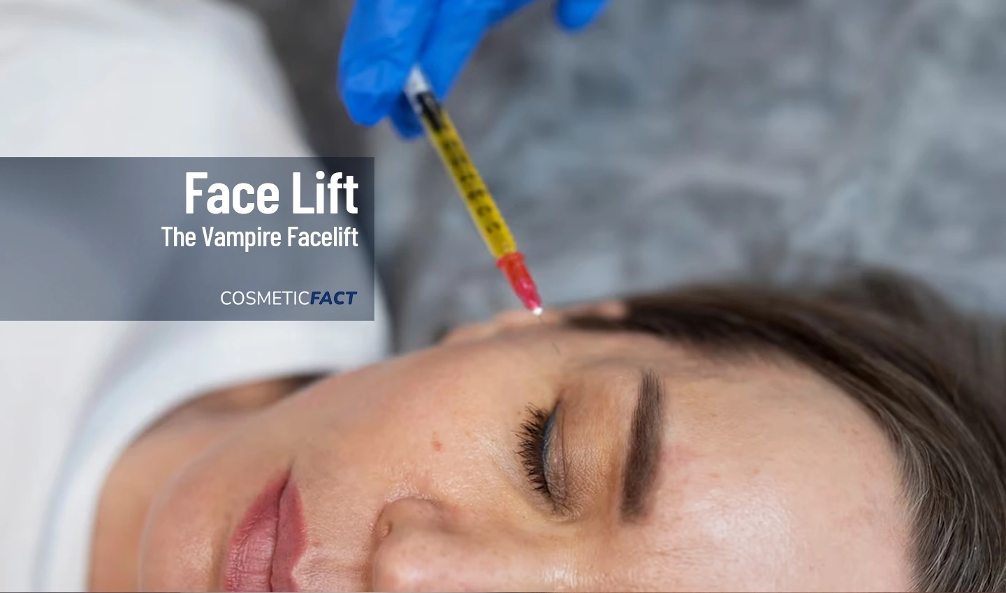 A woman receiving the Vampire Facelift treatment, with platelet-rich plasma being injected into her scalp.
