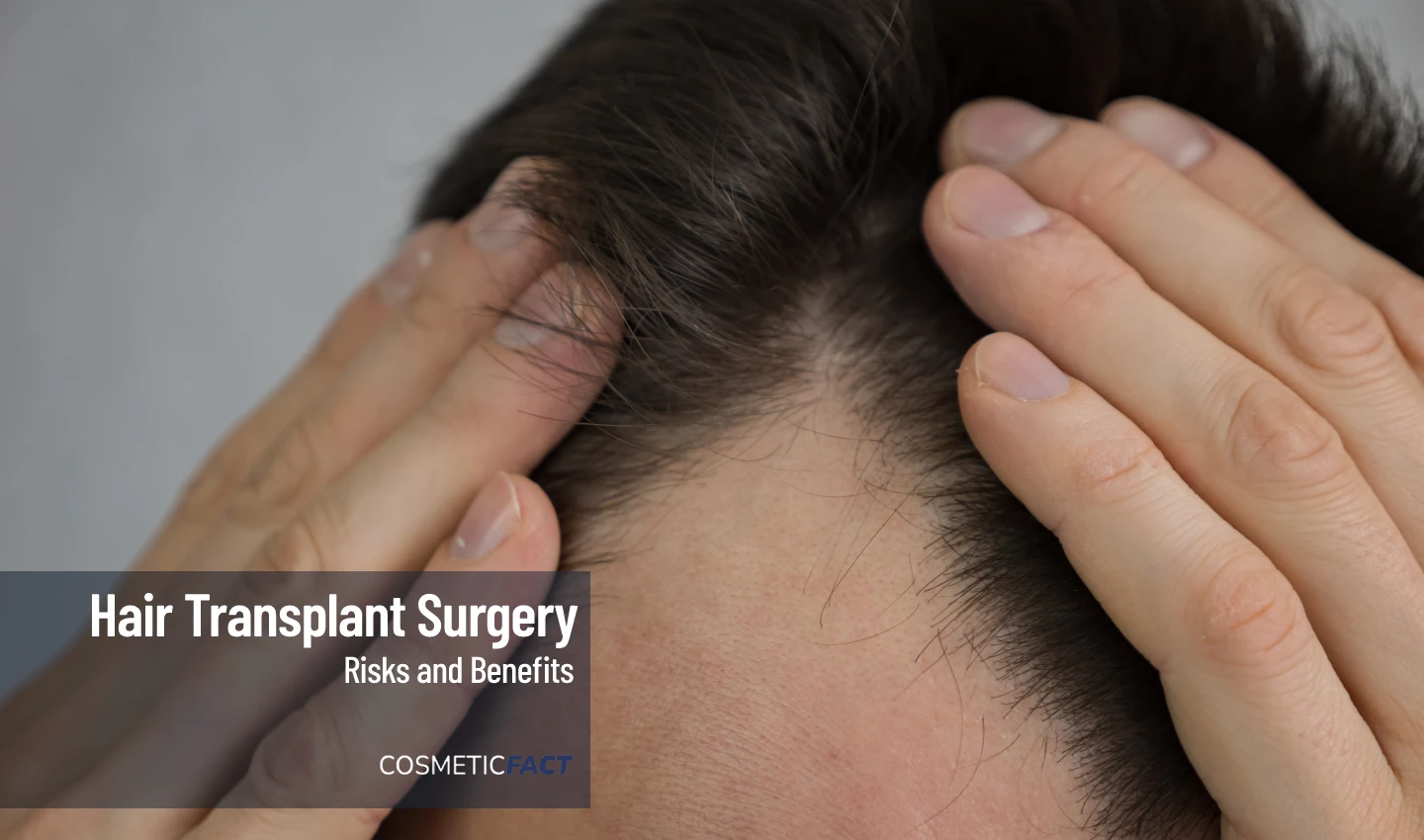 Image of a team of hair transplant surgeons performing a hair implant surgery on a patient, highlighting the importance of choosing the right hair transplant surgeon for a successful procedure.