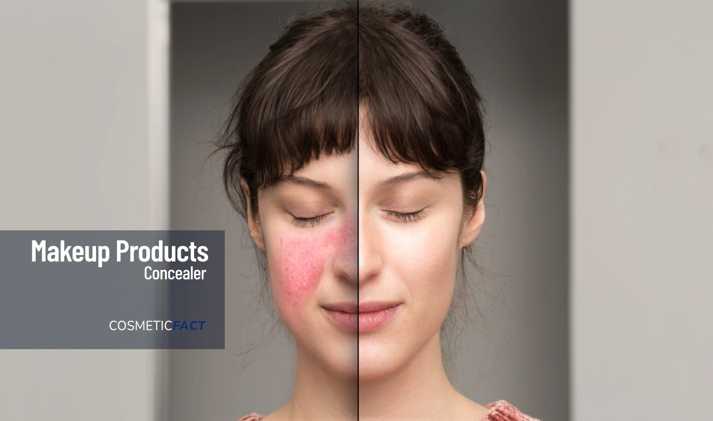 Image of a woman with half her face with a big red spot and the other half covered with concealer, showcasing the effectiveness of acne-prone skin concealers.