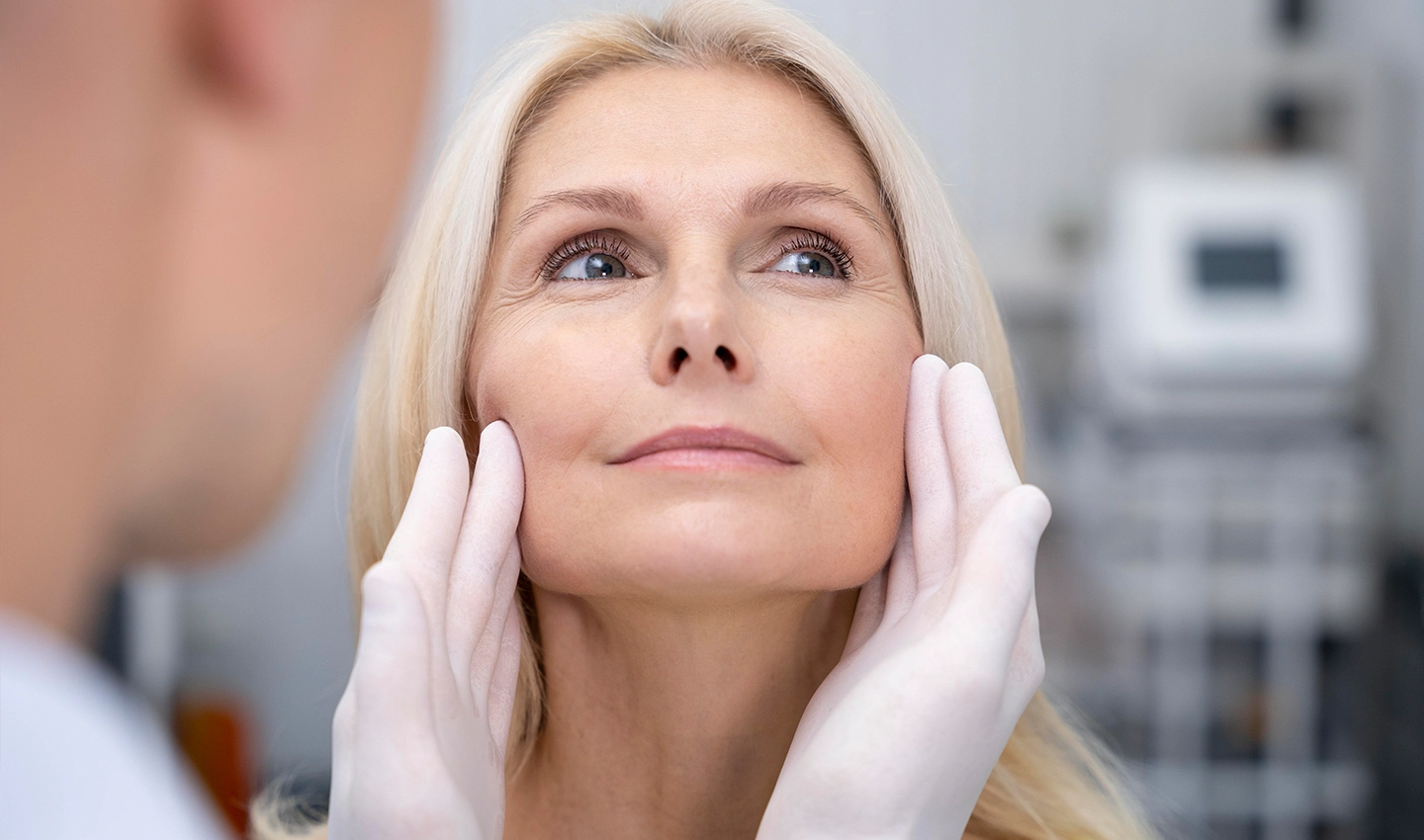 A woman with a natural-looking facelift result