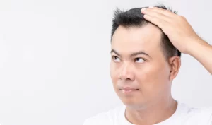 A man standing in front of a mirror, looking at his hair after a hair transplant surgery, following post-operative hair transplant care instructions.a
