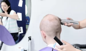 A man getting his head shaved as part of pre-operative hair transplant preparation.