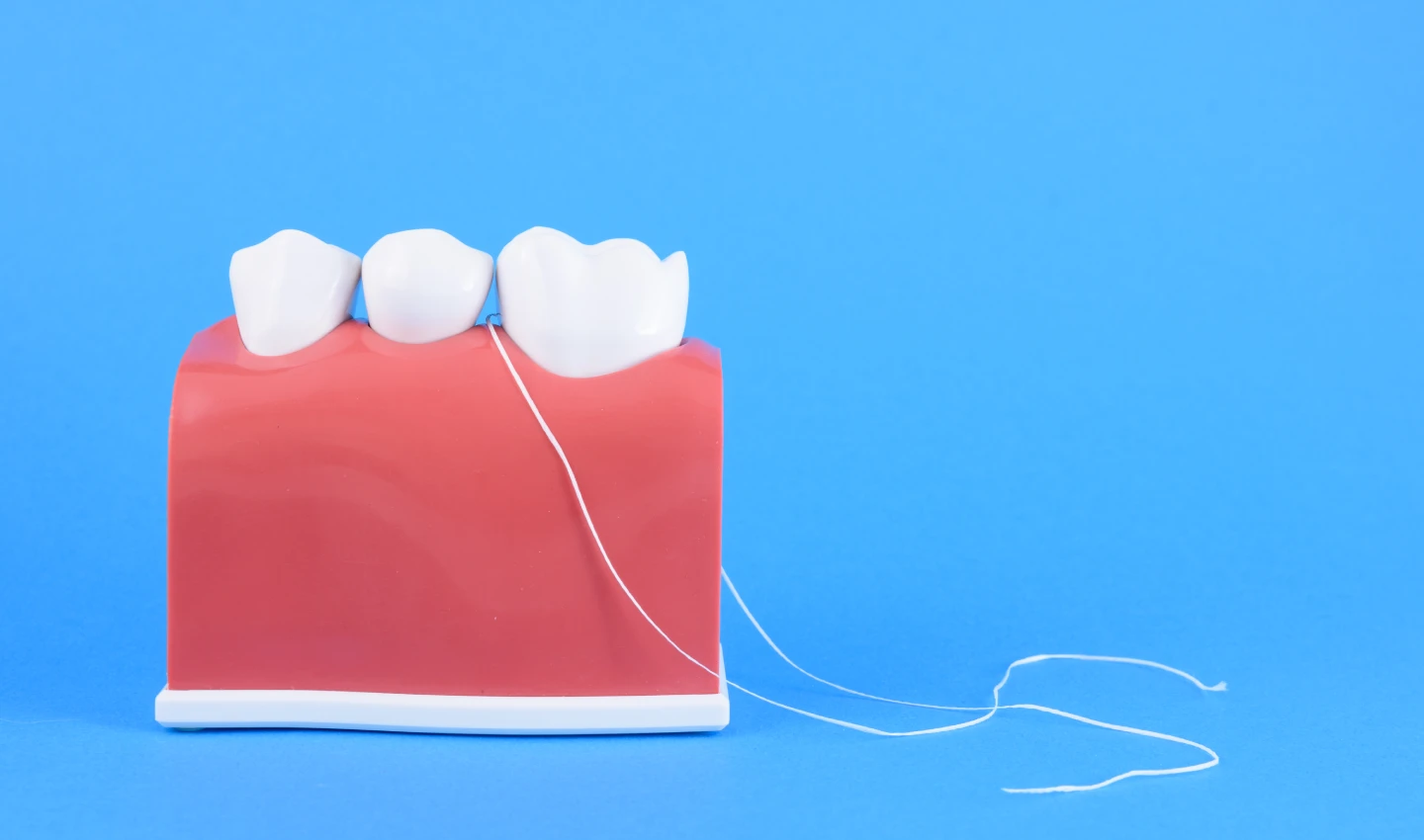 Image showing dental floss being used between teeth to demonstrate proper dental flossing techniques for optimal oral health.