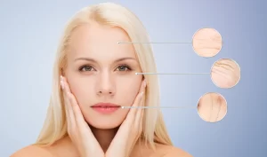 Before and after photo of a woman showing wrinkles on different parts of her face, demonstrating the effectiveness of non-surgical anti-aging techniques for wrinkle reduction.