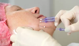 Woman receiving dermal filler injection for skin revitalization and anti-aging purposes, showcasing the benefits of dermal fillers as an alternative to facelift surgery.