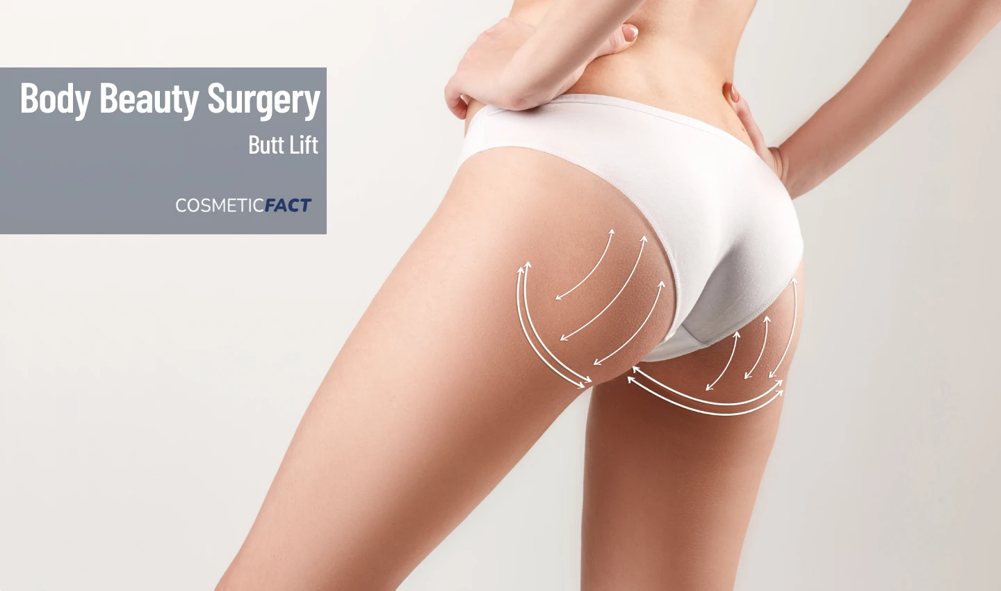 Image of a woman's buttocks with before surgery lines showing the places that were lifted during a butt lift procedure.