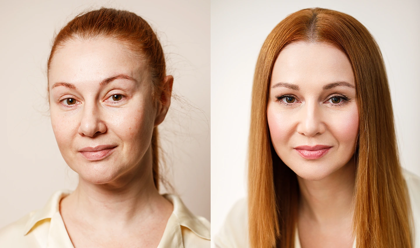 Facelift Success Stories from Real Patients who Share their Before and After Photos