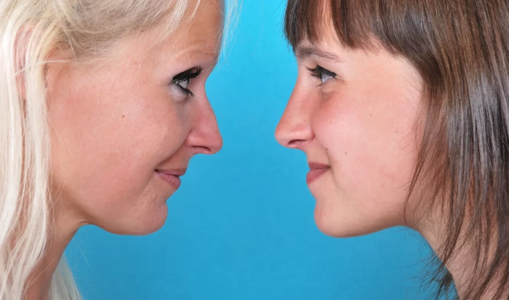 Side image of two women looking at each other, highlighting the difference in their facial profile. One woman has a double chin, while the other does not. The image represents the comparison between Kybella and traditional surgery for double chin reduction