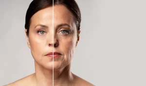 Before-and-after photo of a woman's face, with one side showing her before facelift surgery and the other side showing her after surgery resulted from realistic expectations."