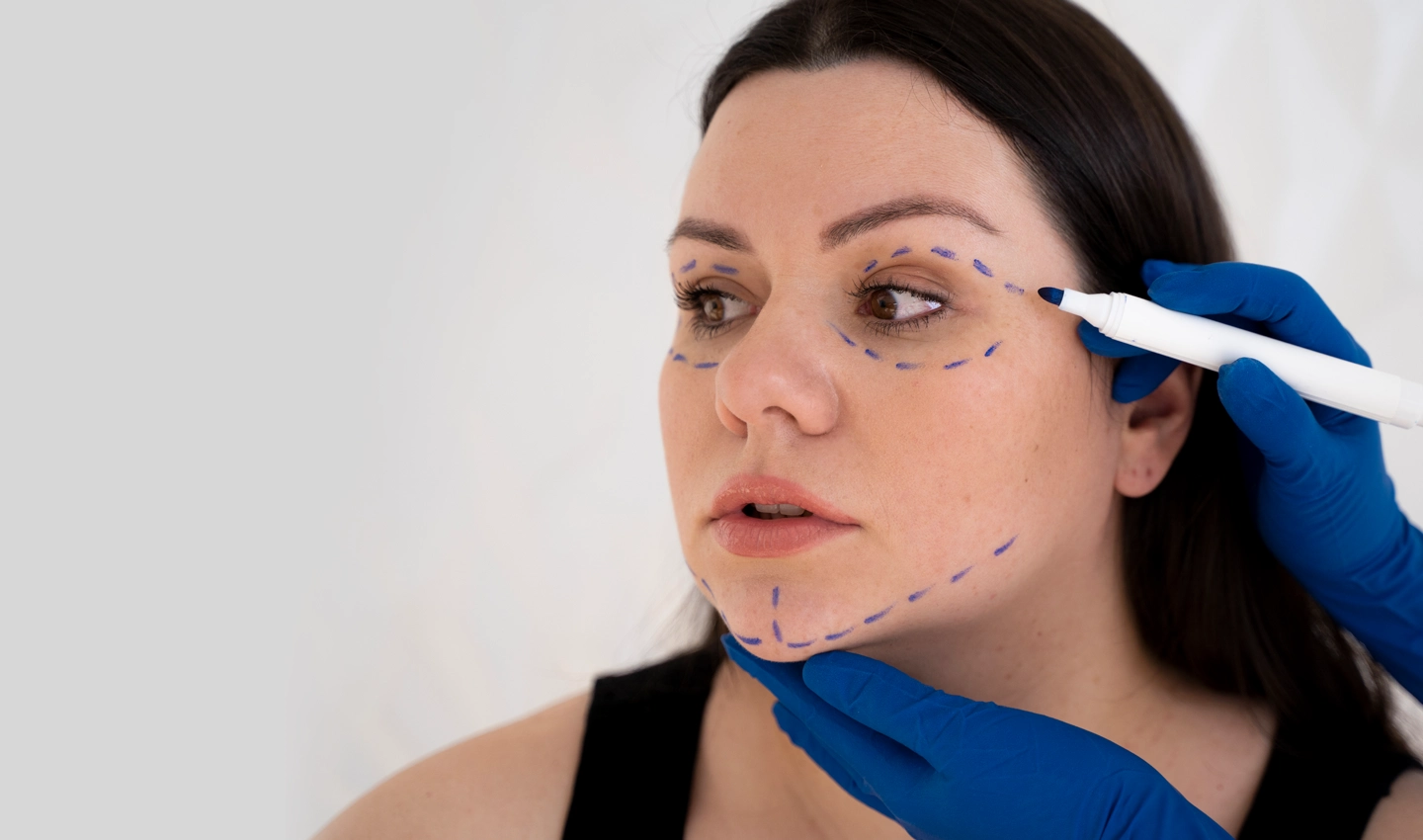 A woman prepares for a facelift and eyelid surgery procedure with a surgeon in a medical setting