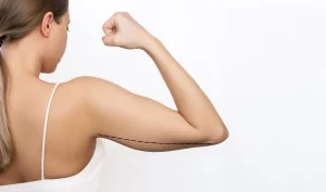Image of a woman's arm lined up and ready for an arm lift procedure, which helps to remove excess skin and fat from the upper arms.