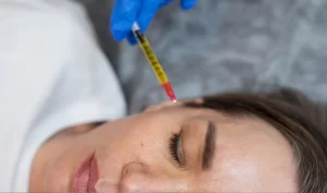 A woman receiving the Vampire Facelift treatment, with platelet-rich plasma being injected into her scalp.