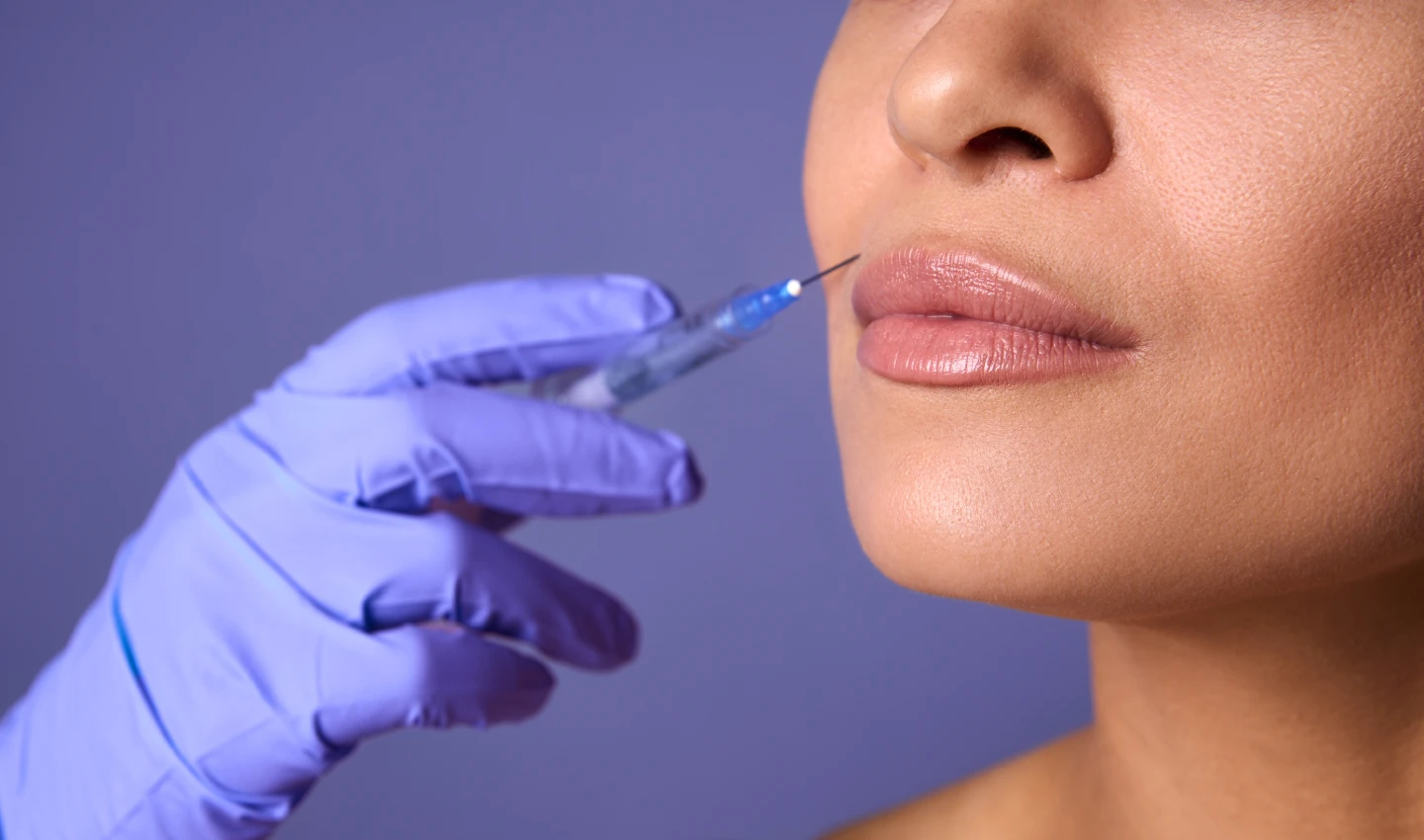 Woman receiving a lip augmentation injection with dermal fillers for plumper lips.