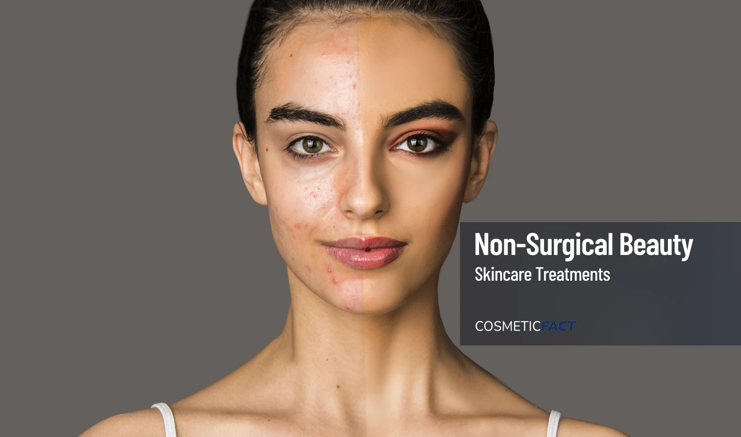 An image split in half, featuring a stunning young lady's face. One side of her face is pigmented and has no makeup, while the other side is even-colored and non-pigmented, with makeup applied. The image emphasizes the effects of hyperpigmentation and the importance of achieving clear and even skin.