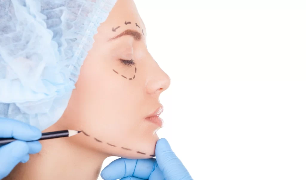 Image of a dermatologist examining a young woman's skin and drawing lines around her eyes, eyebrows, and jawline. The image represents the transformative power of Kybella non-surgical injections in enhancing facial harmony and balance.