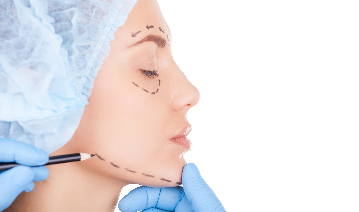 Image of a dermatologist examining a young woman's skin and drawing lines around her eyes, eyebrows, and jawline. The image represents the transformative power of Kybella non-surgical injections in enhancing facial harmony and balance.