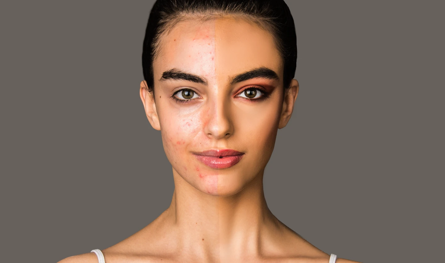 An image split in half, featuring a stunning young lady's face. One side of her face is pigmented and has no makeup, while the other side is even-colored and non-pigmented, with makeup applied. The image emphasizes the effects of hyperpigmentation and the importance of achieving clear and even skin.