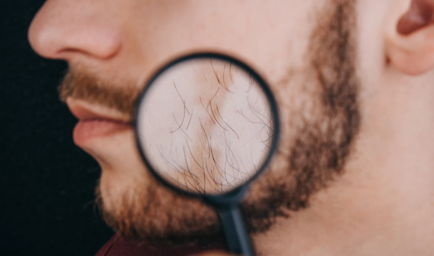 A man looks at his ingrown beard in a mirror while following the guide on preventing ingrown hairs.