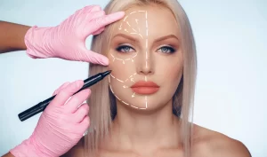 Woman getting marked on her face for non-surgical facial contouring treatment by a doctor.