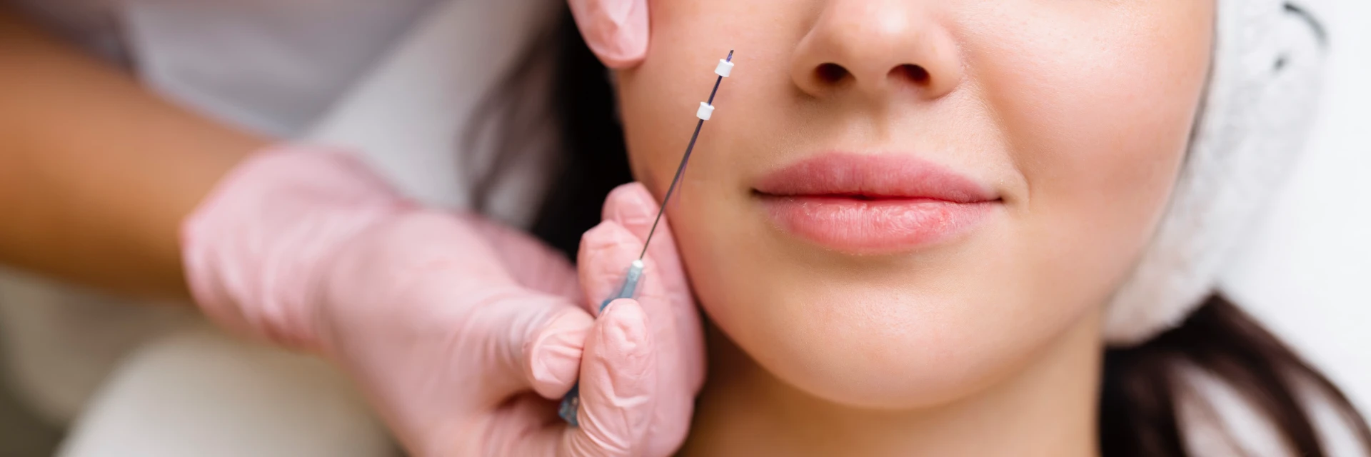 Woman receiving dermal filler injection in her lips