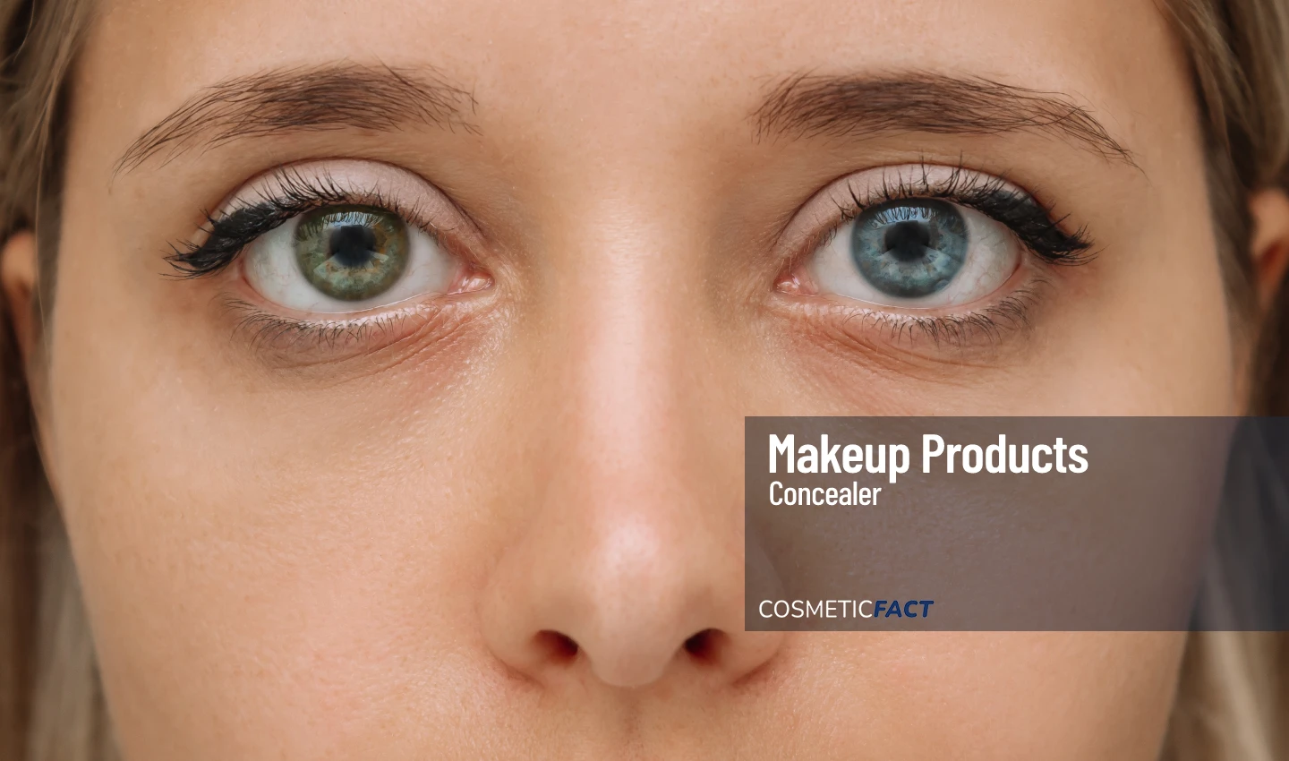 Under-Eye Circles: Close-up of a woman with noticeable dark circles under her eyes