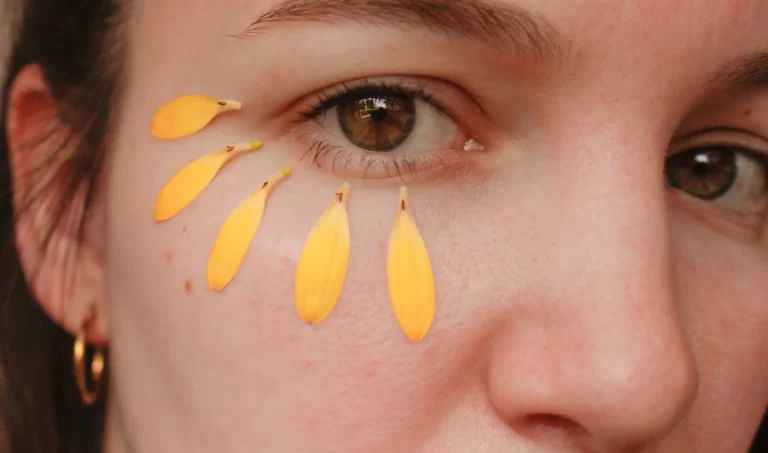 Young woman with captivating eyes demonstrating the benefits of arnica flower for under-eye puffiness